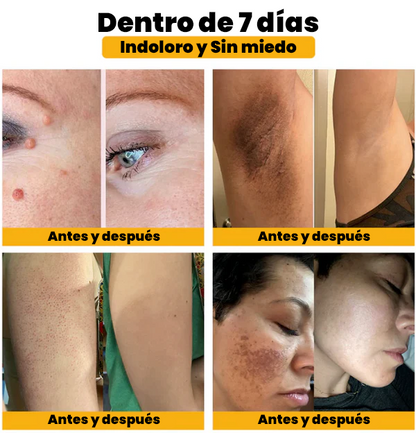 ✨Crema Antiedad Bee Venom🐝