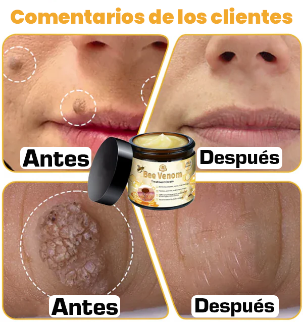 ✨Crema Antiedad Bee Venom🐝