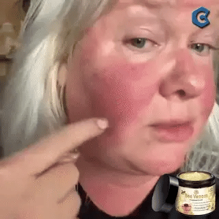 ✨Crema Antiedad Bee Venom🐝